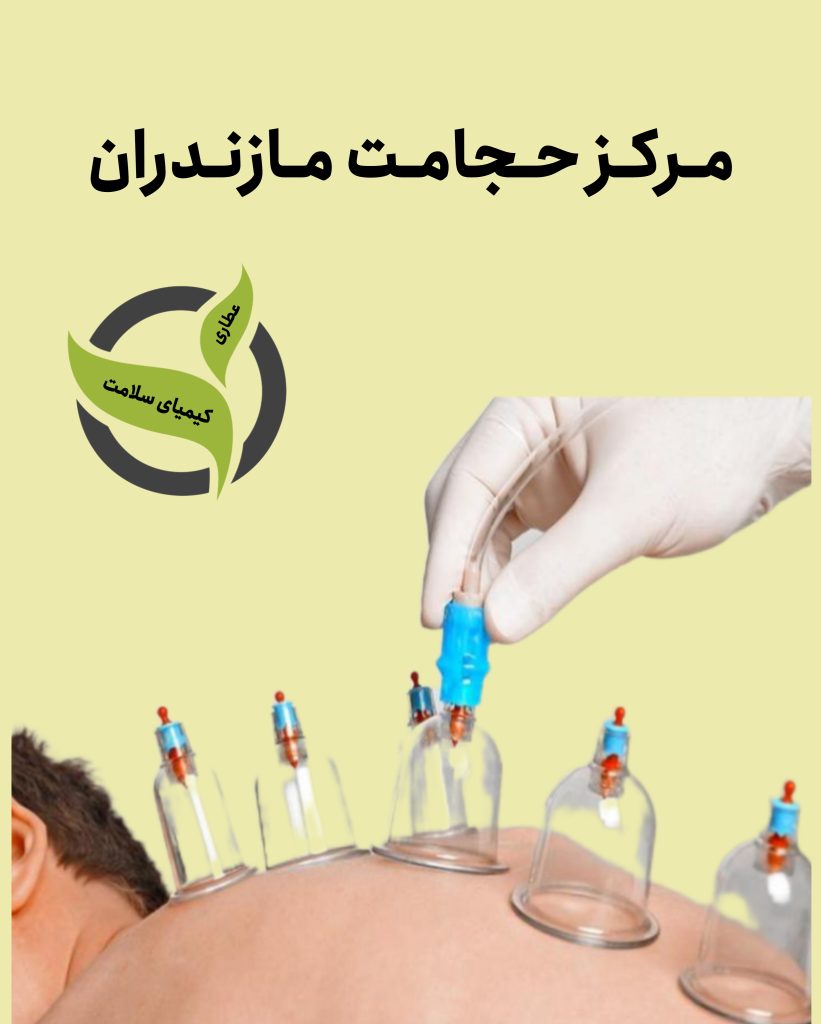 بهترین مرکز حجامت در استان مازندران | عطاری کیمیای سلامت | شماره تماس 01133378386